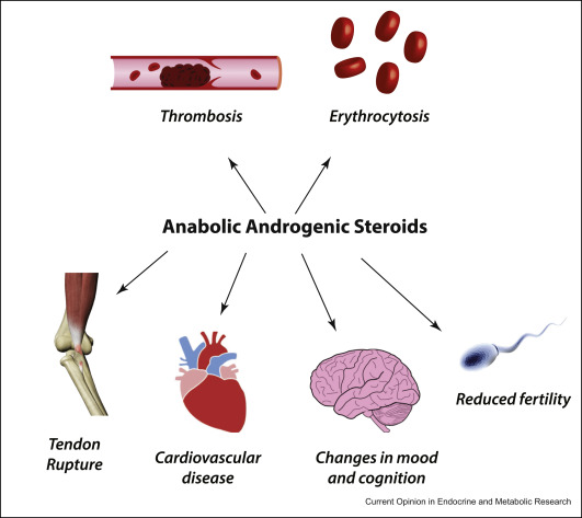 anabolic steroids risks