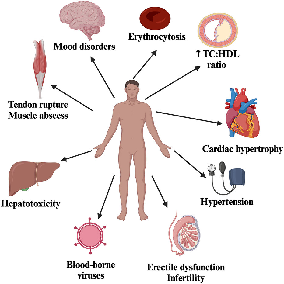 Best anabolic steroids,